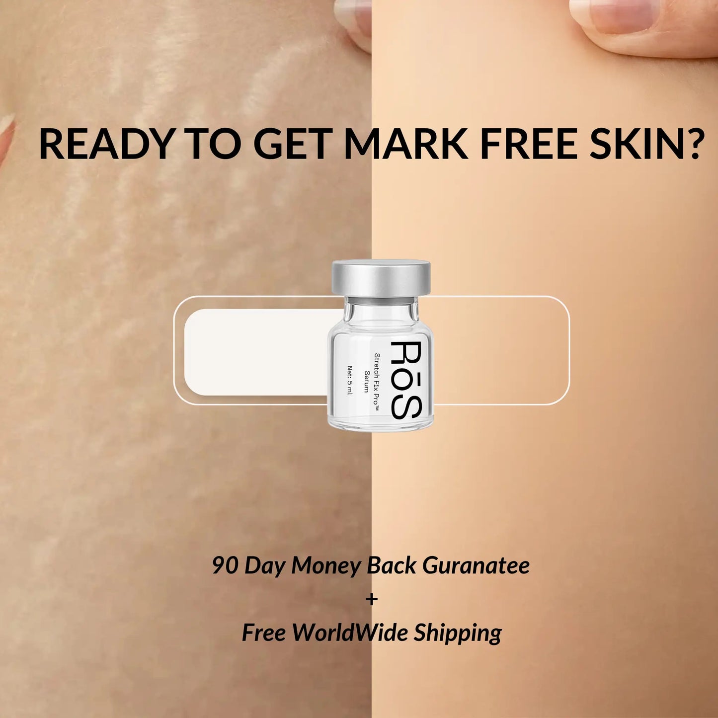 StretchFix Pro™ — Advanced Stretch Mark Repair Kit