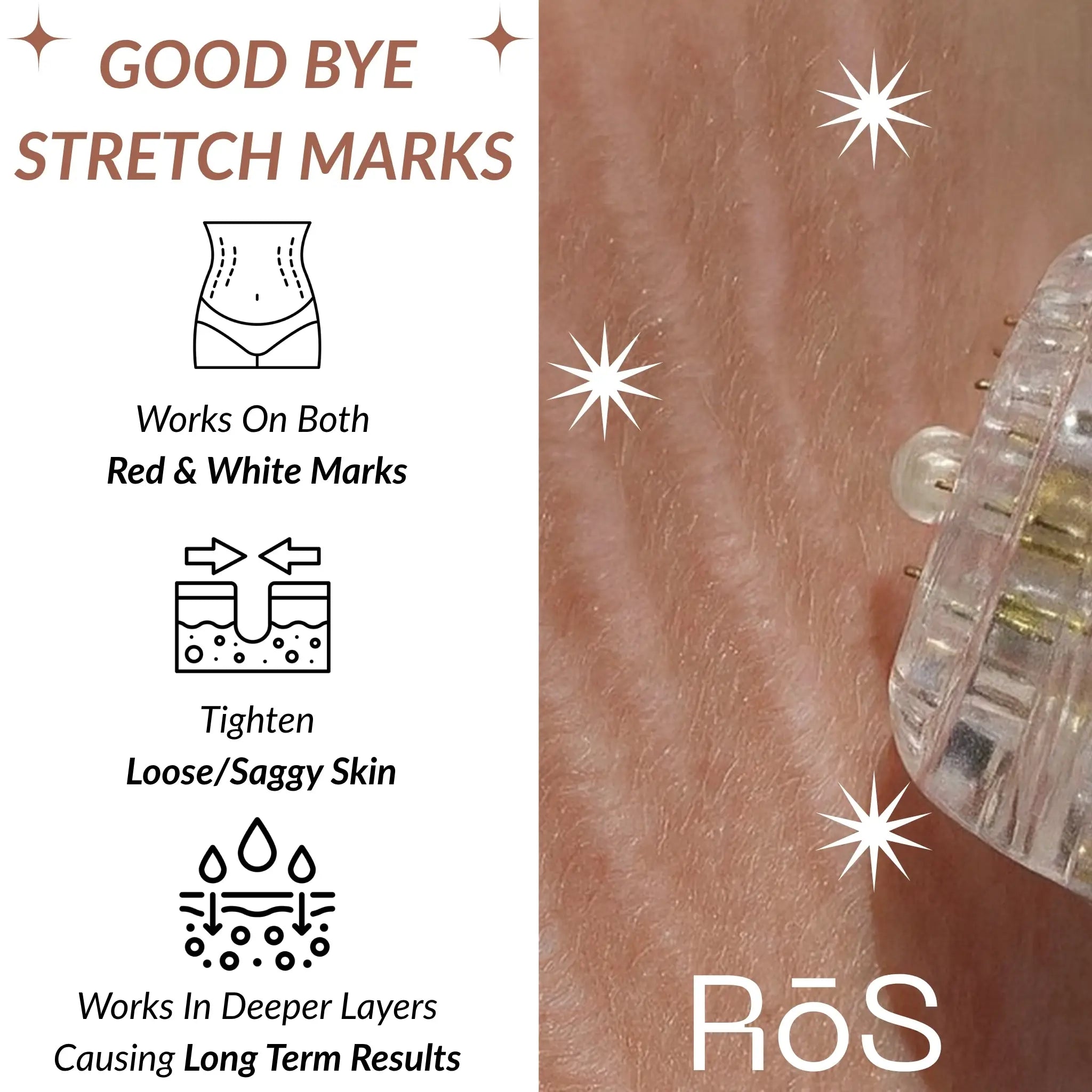 StretchFix Pro™ — Advanced Stretch Mark Repair Kit