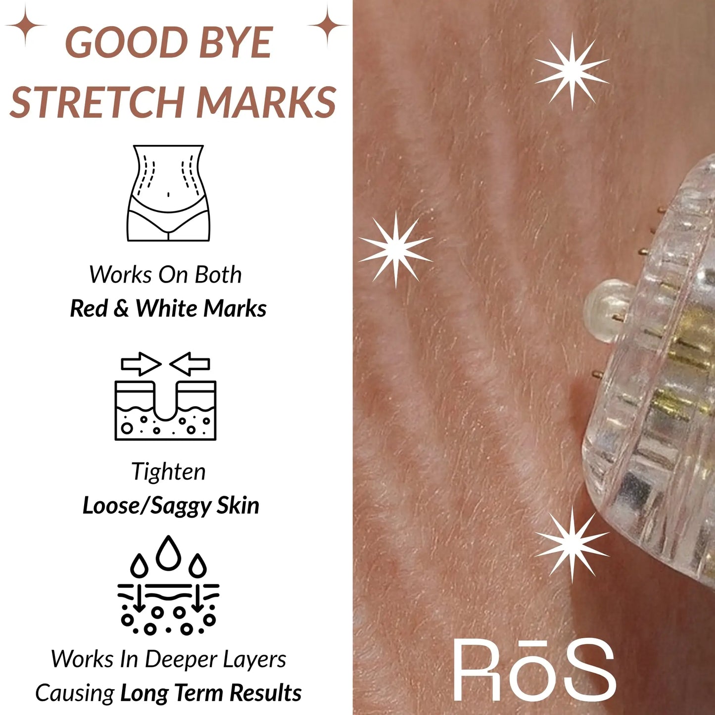 StretchFix Pro™ — Advanced Stretch Mark Repair Kit