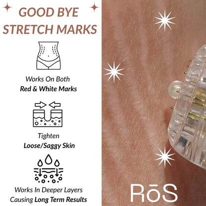 StretchFix Pro™ — Advanced Stretch Mark Repair Kit