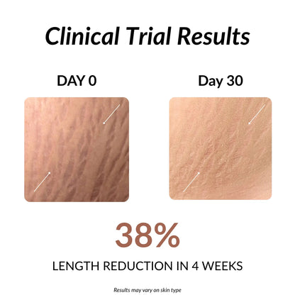 StretchFix Pro™ — Advanced Stretch Mark Repair Kit