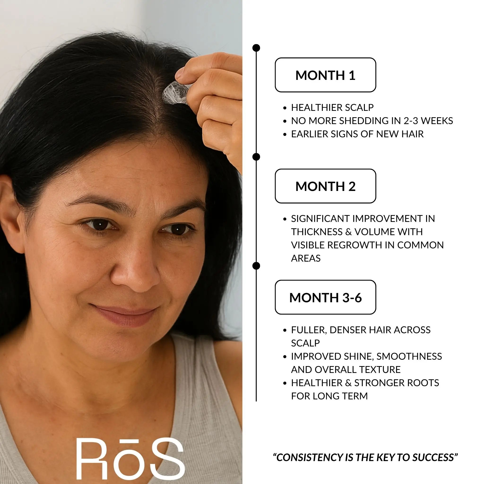 RōS Hair Regrowth Solution