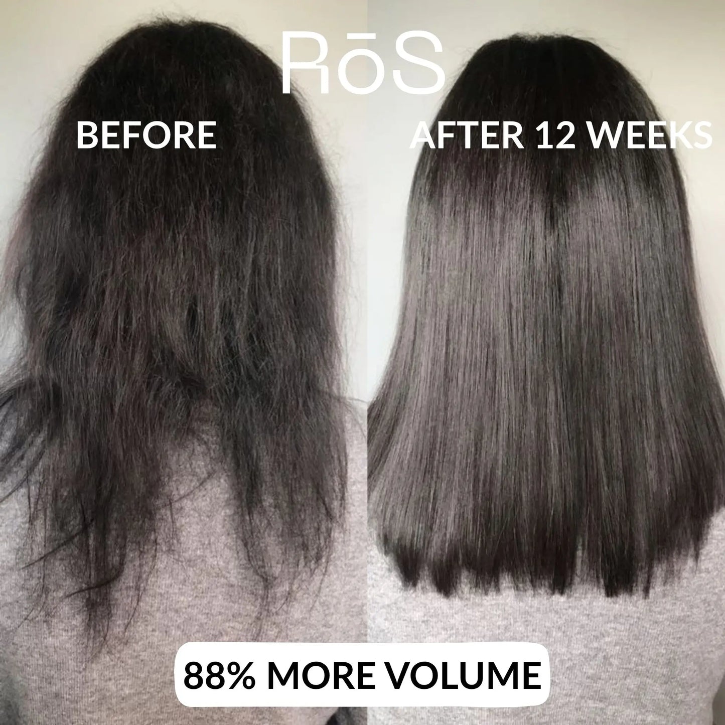 RōS Hair Regrowth Solution