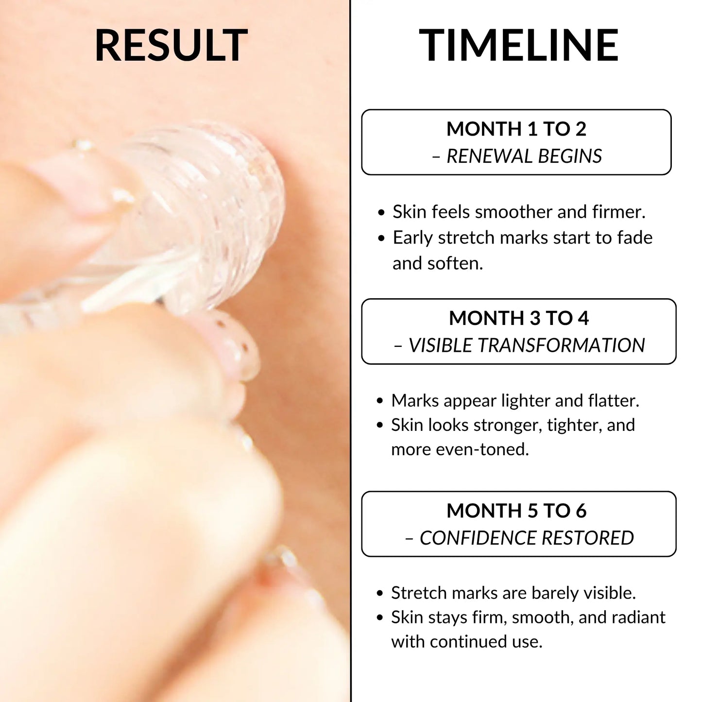 StretchFix Pro™ — Advanced Stretch Mark Repair Kit