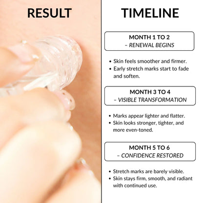 StretchFix Pro™ — Advanced Stretch Mark Repair Kit