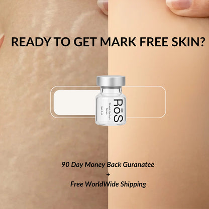 StretchFix Pro™ — Advanced Stretch Mark Repair Kit